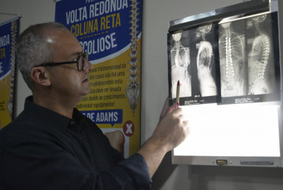 Volta Redonda comemora cinco anos do ‘Coluna Reta’ no mês da conscientização mundial da escoliose