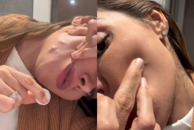 Maíra Cardi usou o 'TikTok' para falar sobre as complicações que enfrenta após a aplicação de PMMA - Reprodução / Tiktok