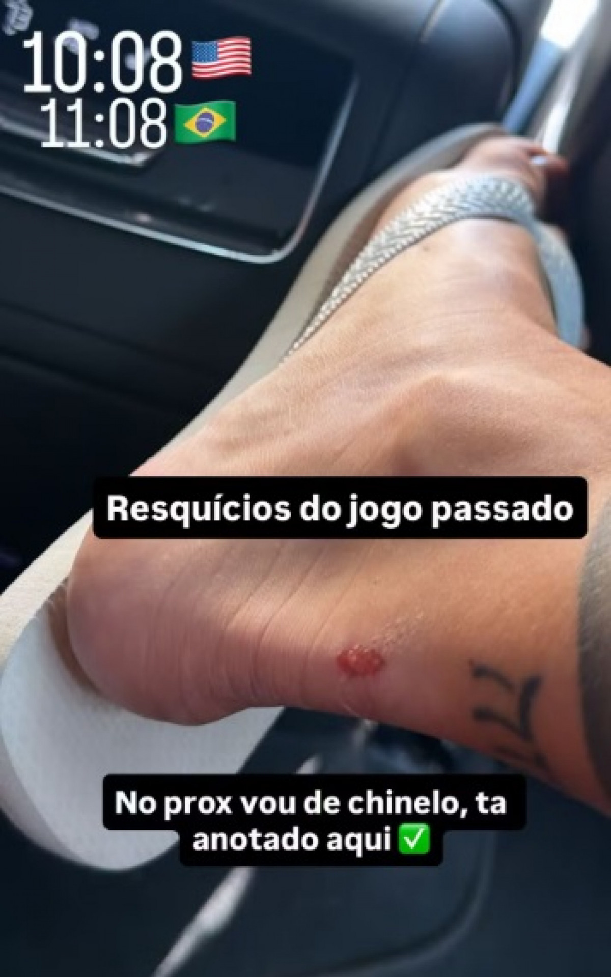 Virginia exibe ferimento no p&eacute; ap&oacute;s jogos do Brasil - Reprodu&ccedil;&atilde;o Instagram