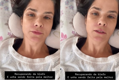 Samara Felippo mostra recuperação de cirurgia nas pálpebras