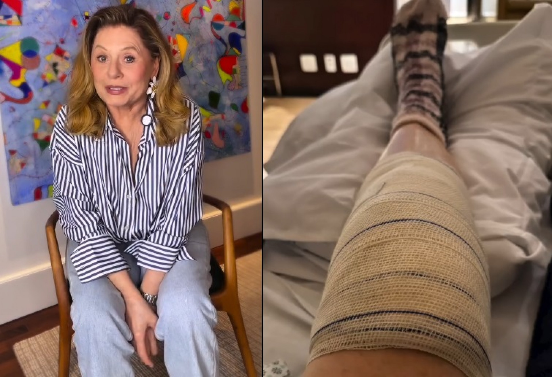 Vera Fischer revela cirurgia no joelho  - Reprodução do Instagram
