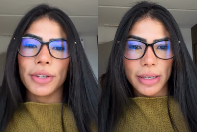 Marciele Albuquerque relata alopecia por estresse após Parintins