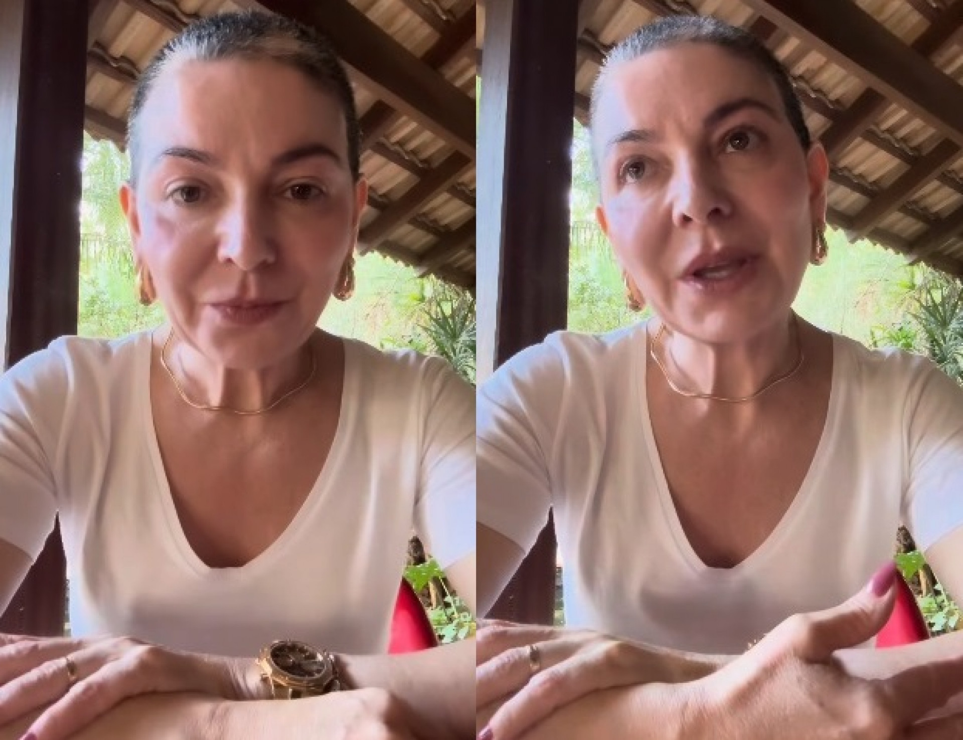 Karina Lucco fez relato sobre luta contra alopecia - Reprodução/Instagram