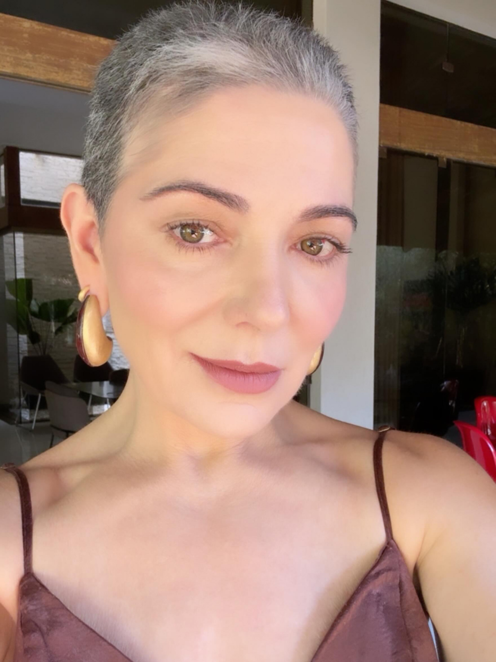 Mãe de Lucas Lucco sofre com condição que causa queda de cabelo - Reprodução/Instagram
