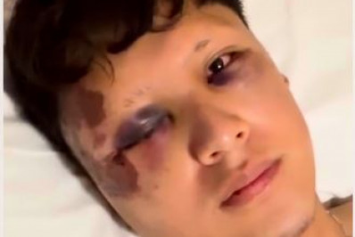 Polícia Civil investiga agressão a turista mexicano em Copacabana