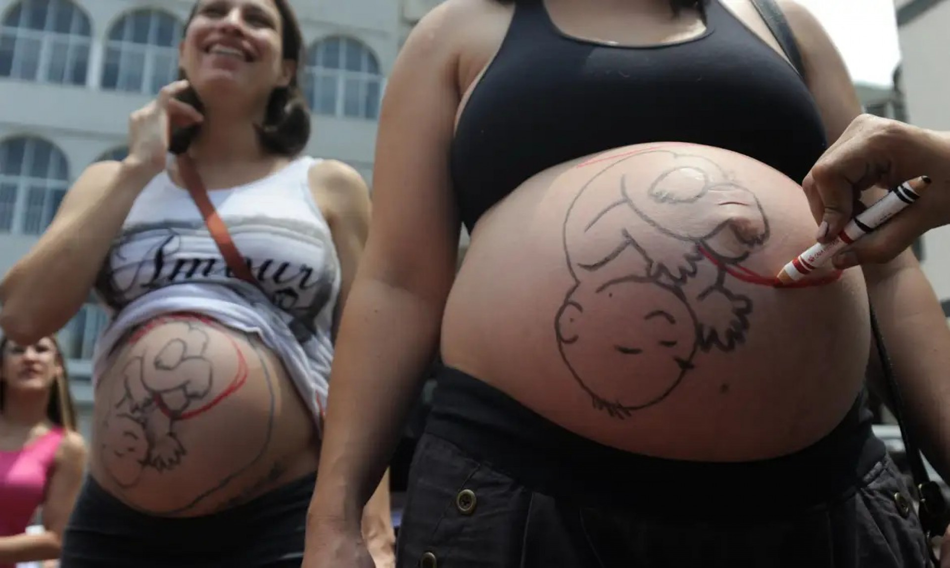 Estudo do Unicef indica que fatores sociais elevam número de cesarianas