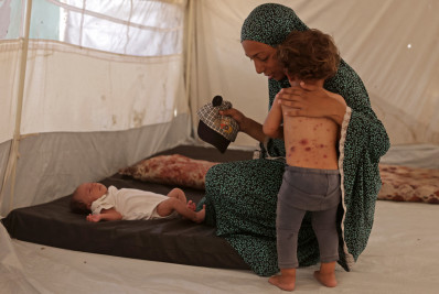 Catapora se espalha em acampamentos superlotados de Gaza