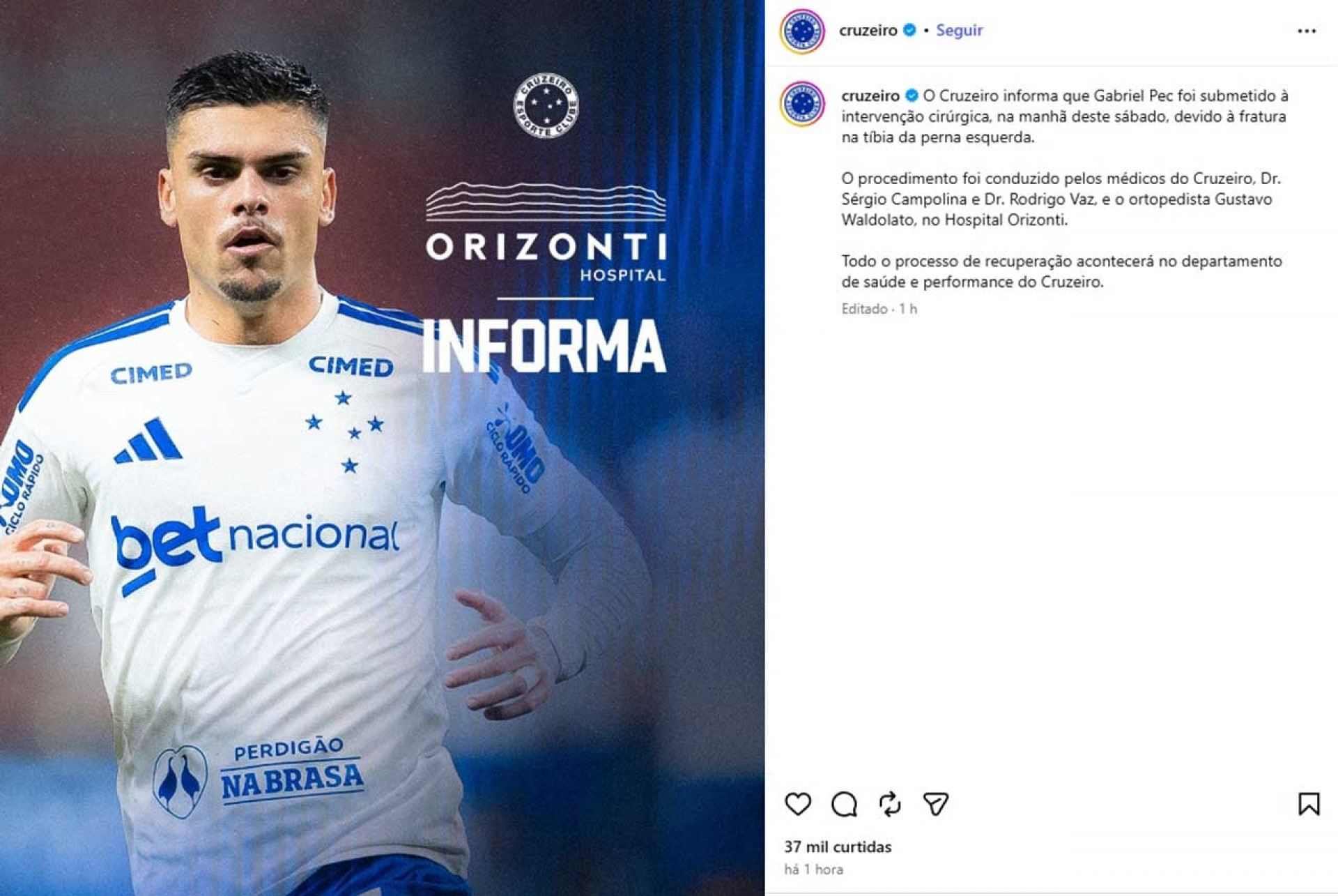 Gabriel Pec passa por cirurgia, e Cruzeiro prev&ecirc; at&eacute; quatro meses de recupera&ccedil;&atilde;o
