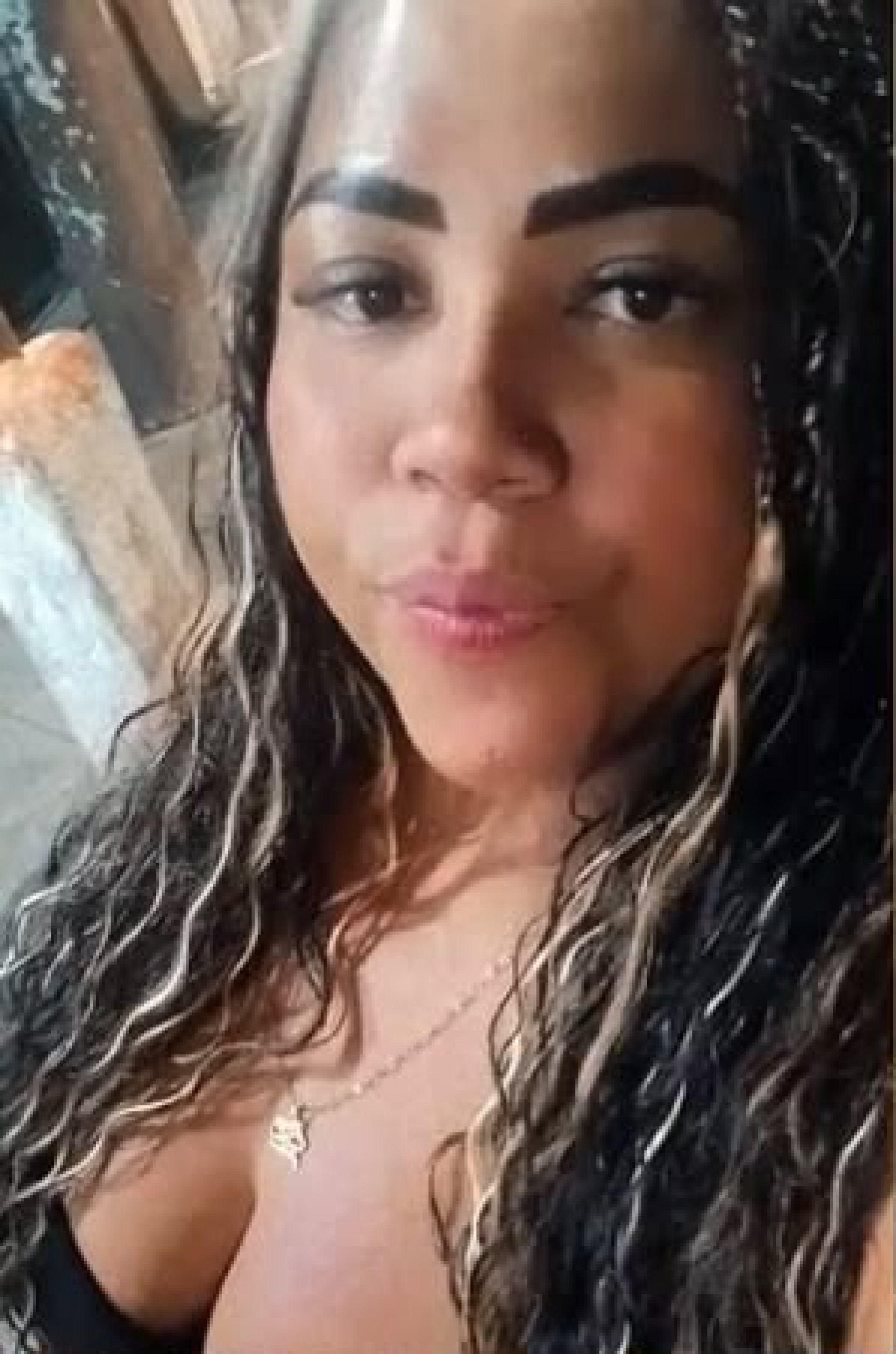 Suellen da Silva Ribeiro, de 36 anos, está internada no Hospital Getúlio Vargas