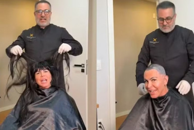 Gretchen raspa a cabeça antes de transplante capilar por alopecia