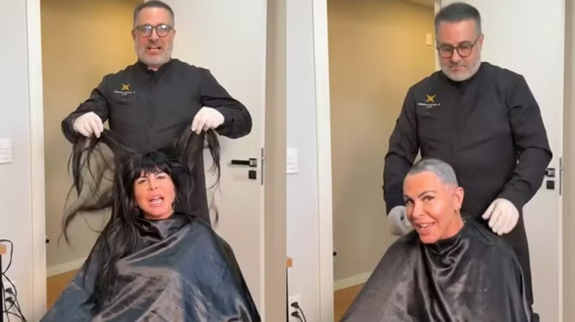 Gretchen raspa a cabeça antes de transplante capilar por alopecia - Reprodução Instagram