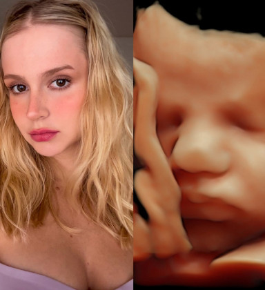 Isabella Scherer mostra ultrassom com rostinho do terceiro filho