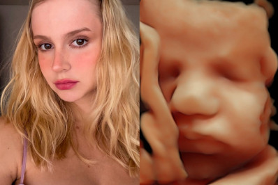 Isabella Scherer mostra ultrassom com rostinho do terceiro filho