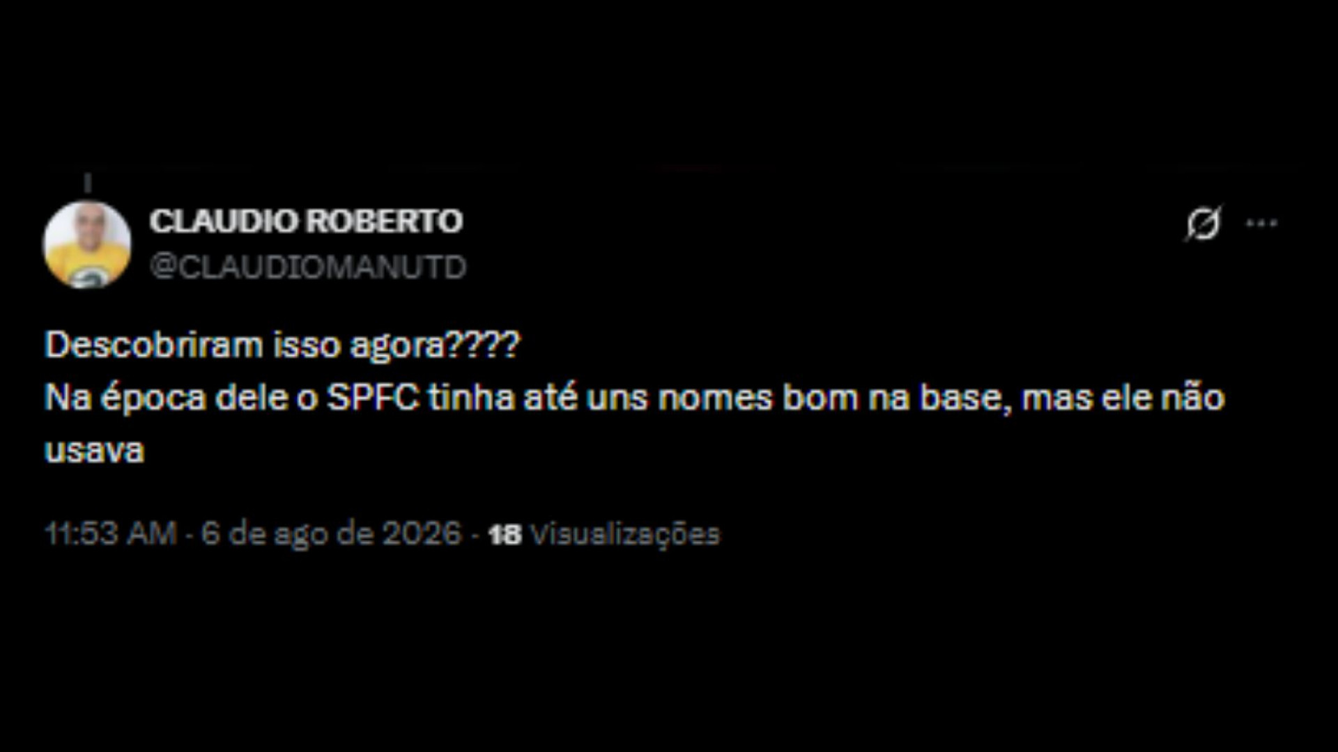Torcedores nas redes sociais concordando com crítica de Roger Flores sobre Luis Zubeldía não usar a base - Reprodução/X @CLAUDIOMANUTD
