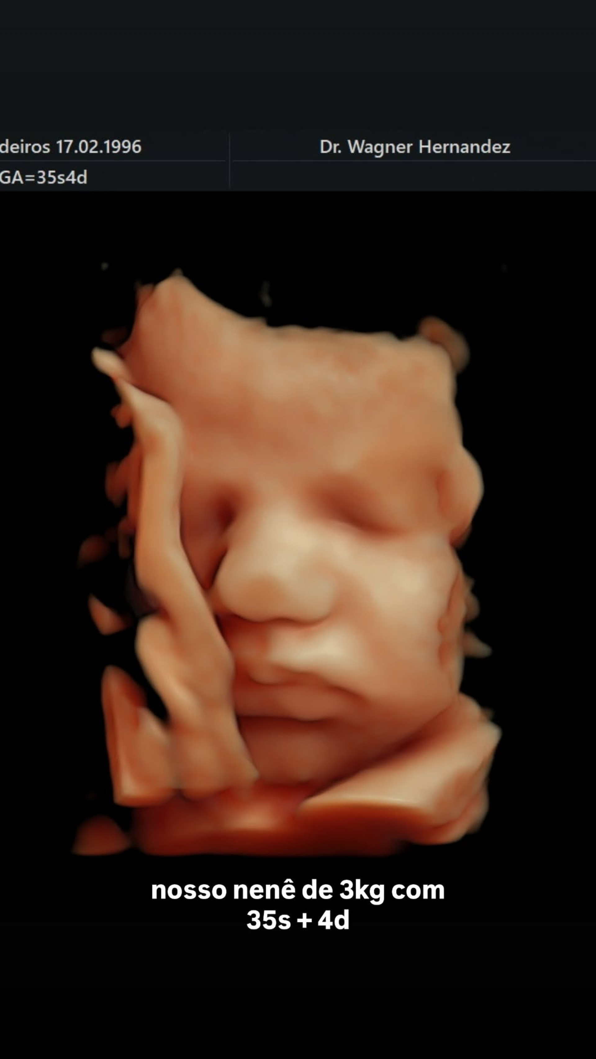 Isabella Scherer realizou ultrassom 3D para na reta final da gravidez - Reprodução/Instagram 