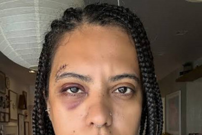 Influenciadora relata agressão durante roda de samba na Lapa