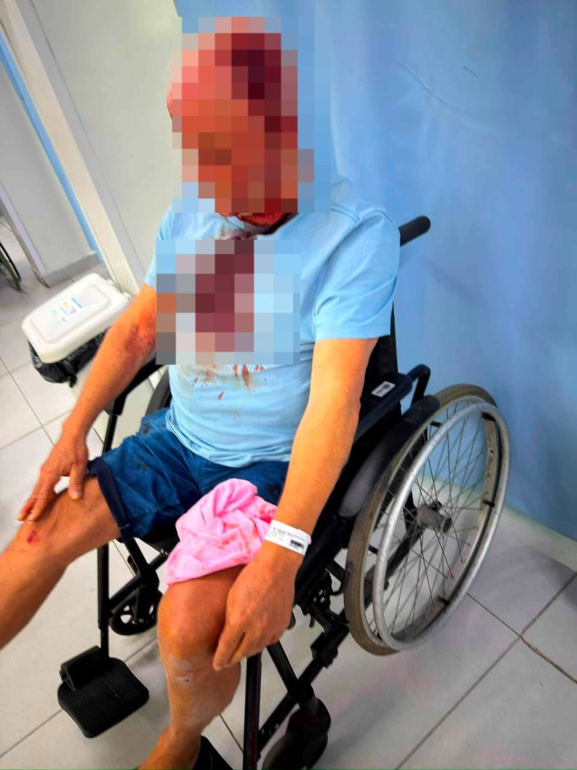 Artur Garcia Botelho foi atendido no Hospital Samaritano e levou 10 pontos na cabeça