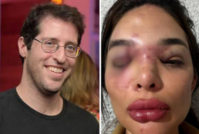 Empresário preso por agredir mulher já foi acusado de crime financeiro