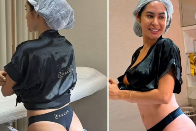 Ex-BBB Isabelle Nogueira exibe novo contorno dos glúteos após procedimento