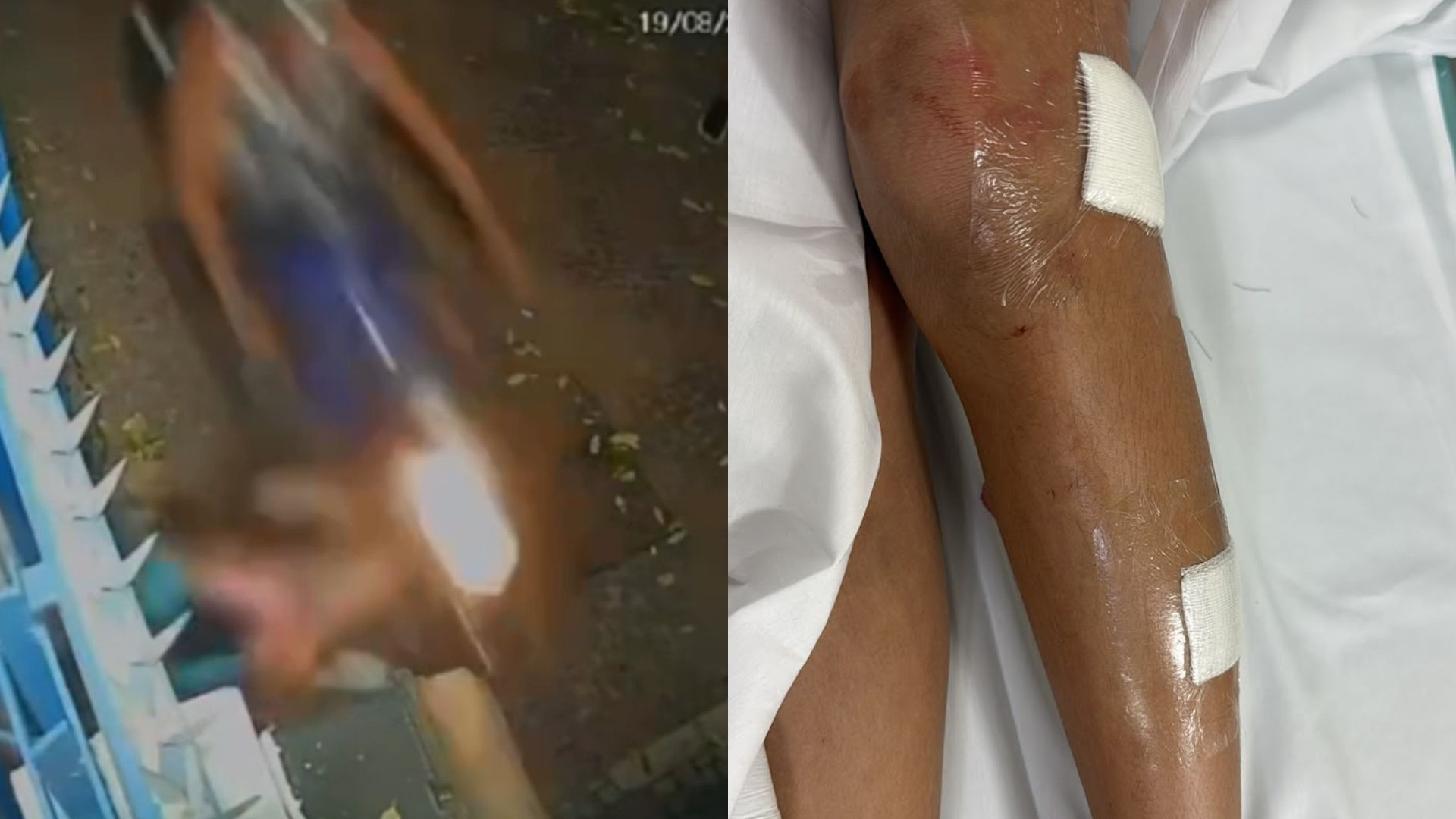 Moto em alta velocidade atingiu a menina quando ela saía da escola de dança - Reprodução/Redes Sociais / Arquivo pessoal