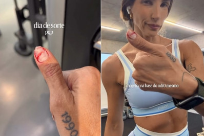 Aline Gotschalg desabafa após sangramento no dedo: 'Dia de sorte'