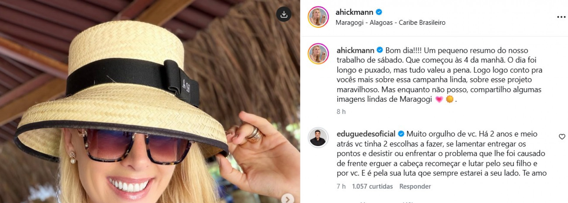 Edu Guedes se declara para Ana Hickmann e relembra fase difícil