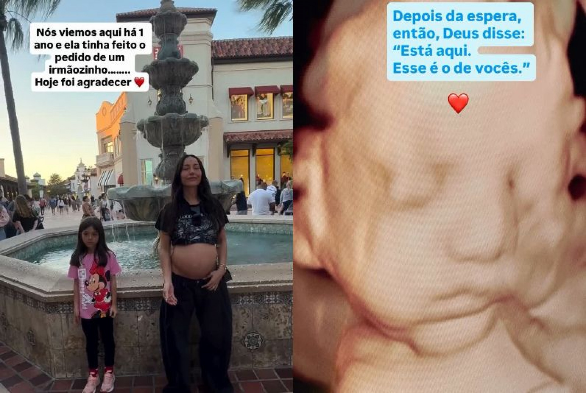 Nicolas Prattes revela imagem de ultrassom de filho com Sabrina Sato