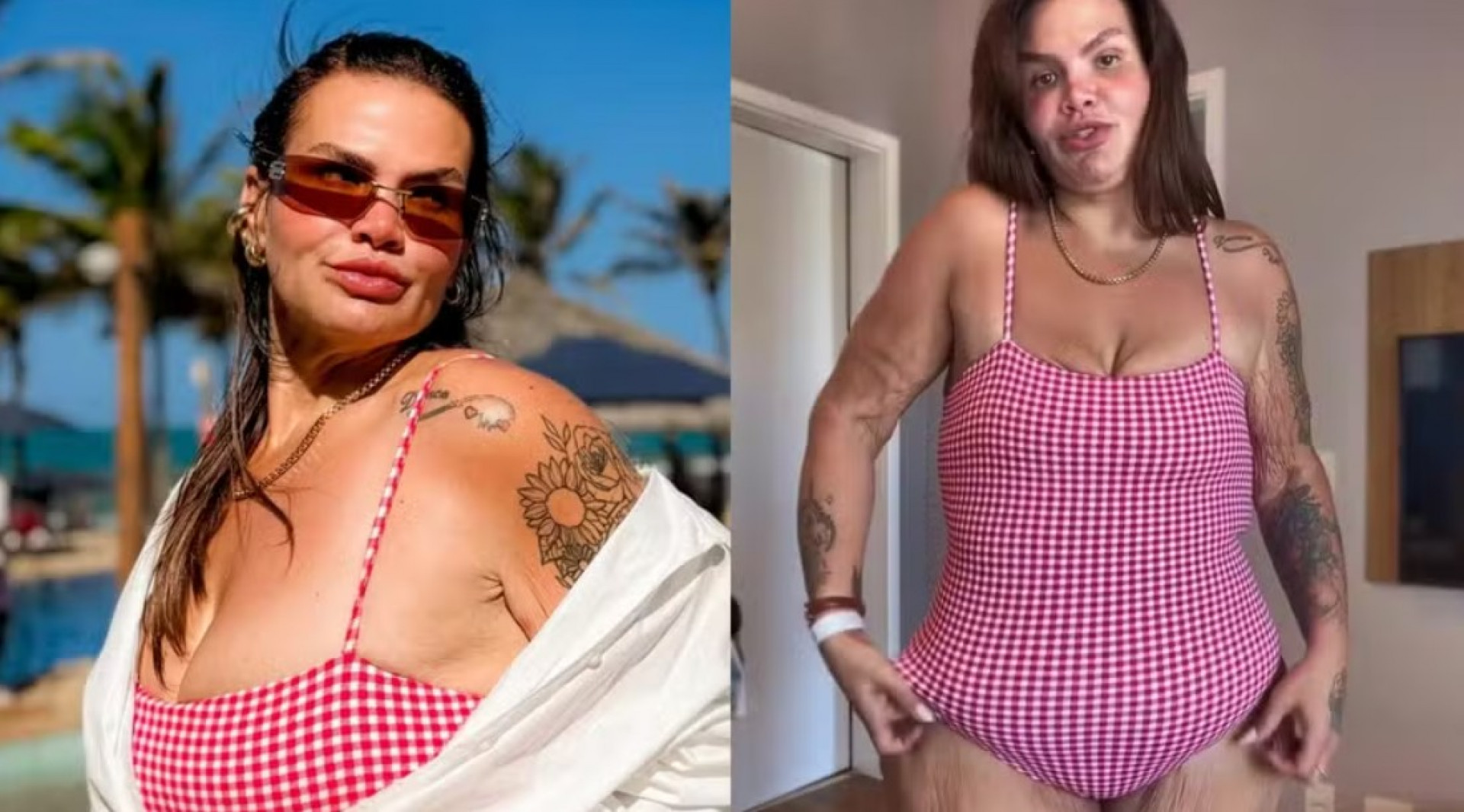 Thais Carla fala sobre excesso de pele após perder 120 kg