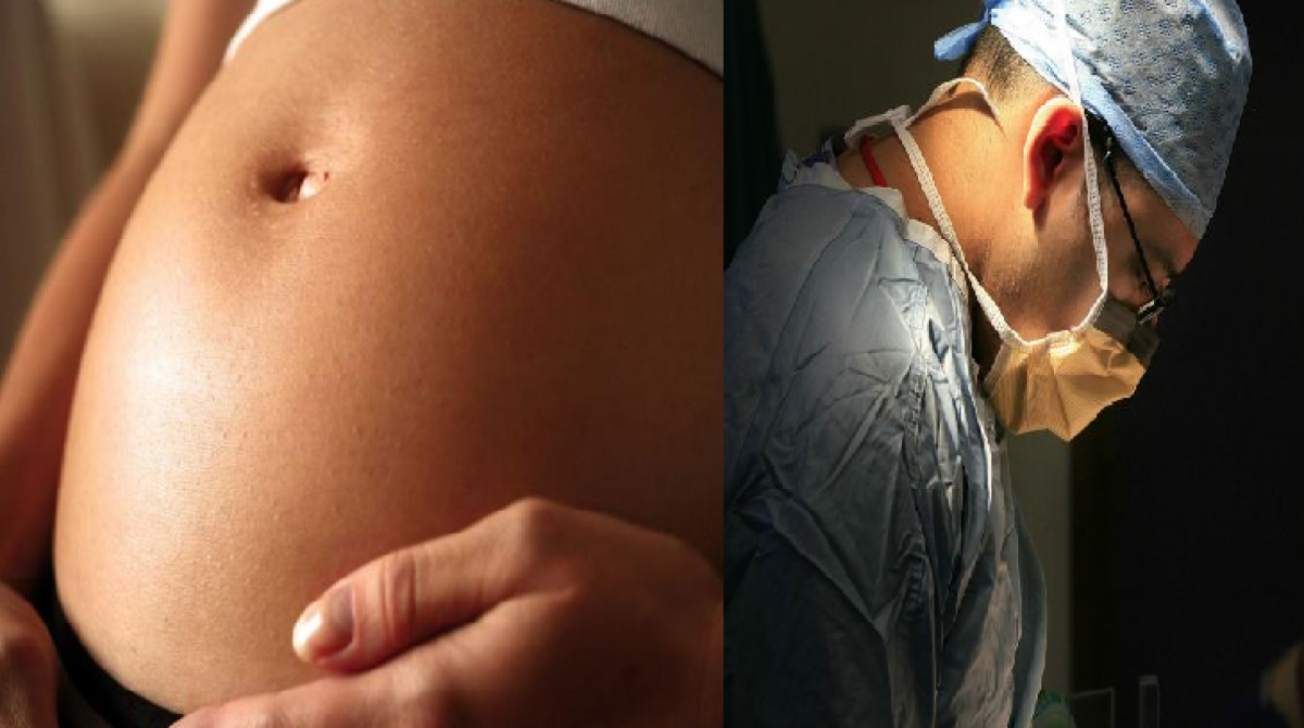 Bebê nasceu com três cabeças