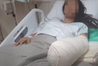 Hospital onde parturiente teve a mão amputada após dar à luz afasta liderança regional médica