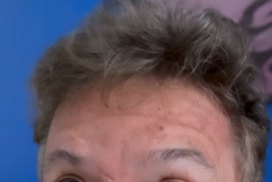 Boninho faz procedimentos estéticos para receber Ana Furtado: 'Ficar bonitinho pra quando ela voltar'