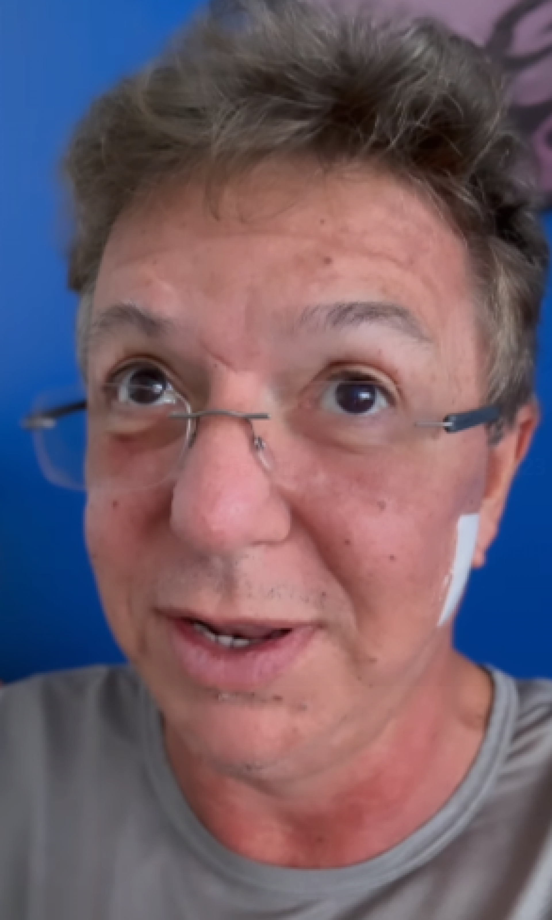 Boninho realiza procedimentos estéticos para agradar Ana Furtado - Reprodução Internet