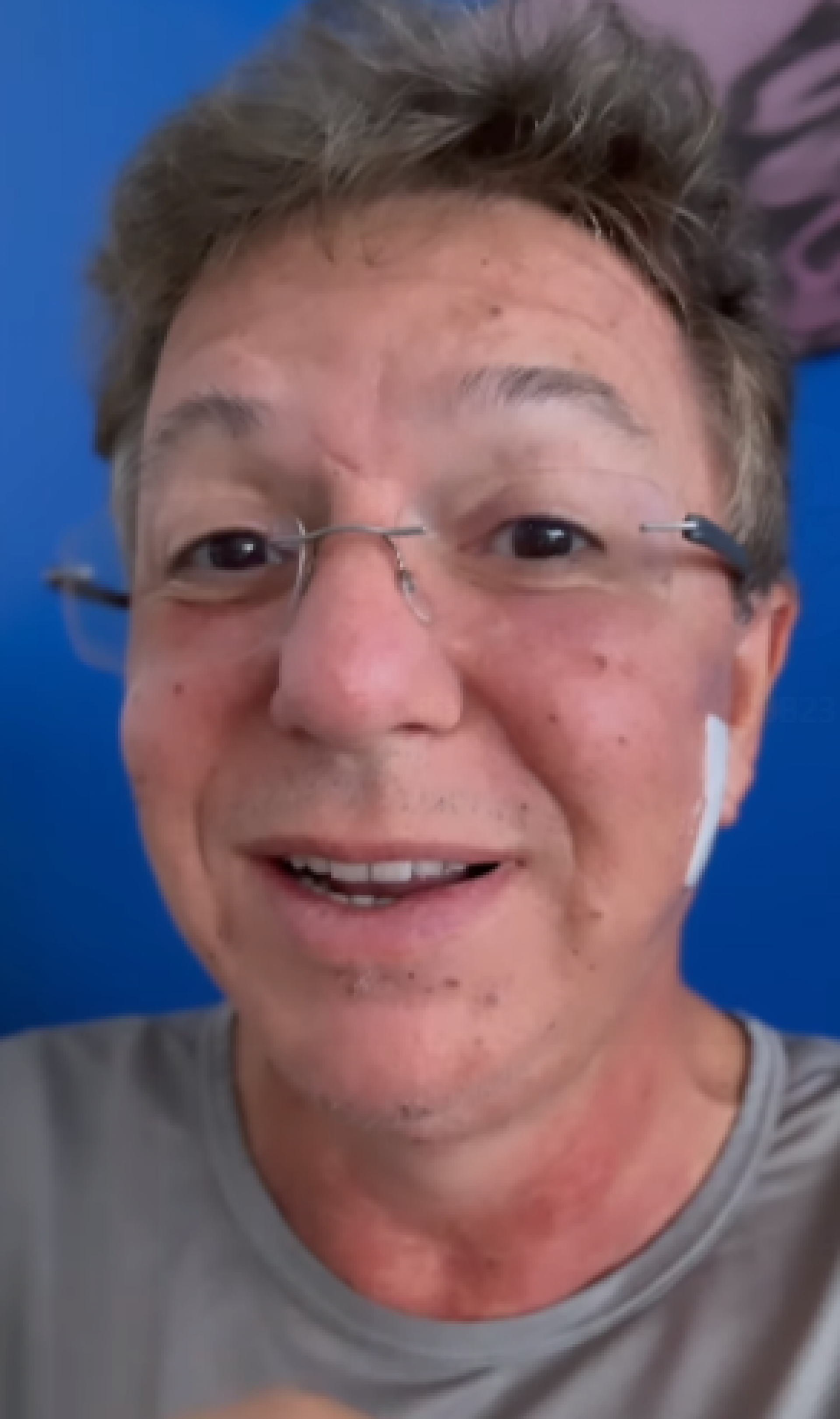 Boninho realiza procedimentos estéticos para agradar Ana Furtado - Reprodução Internet