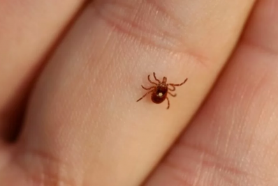 Febre maculosa: conheça sintomas, causas e tratamento 