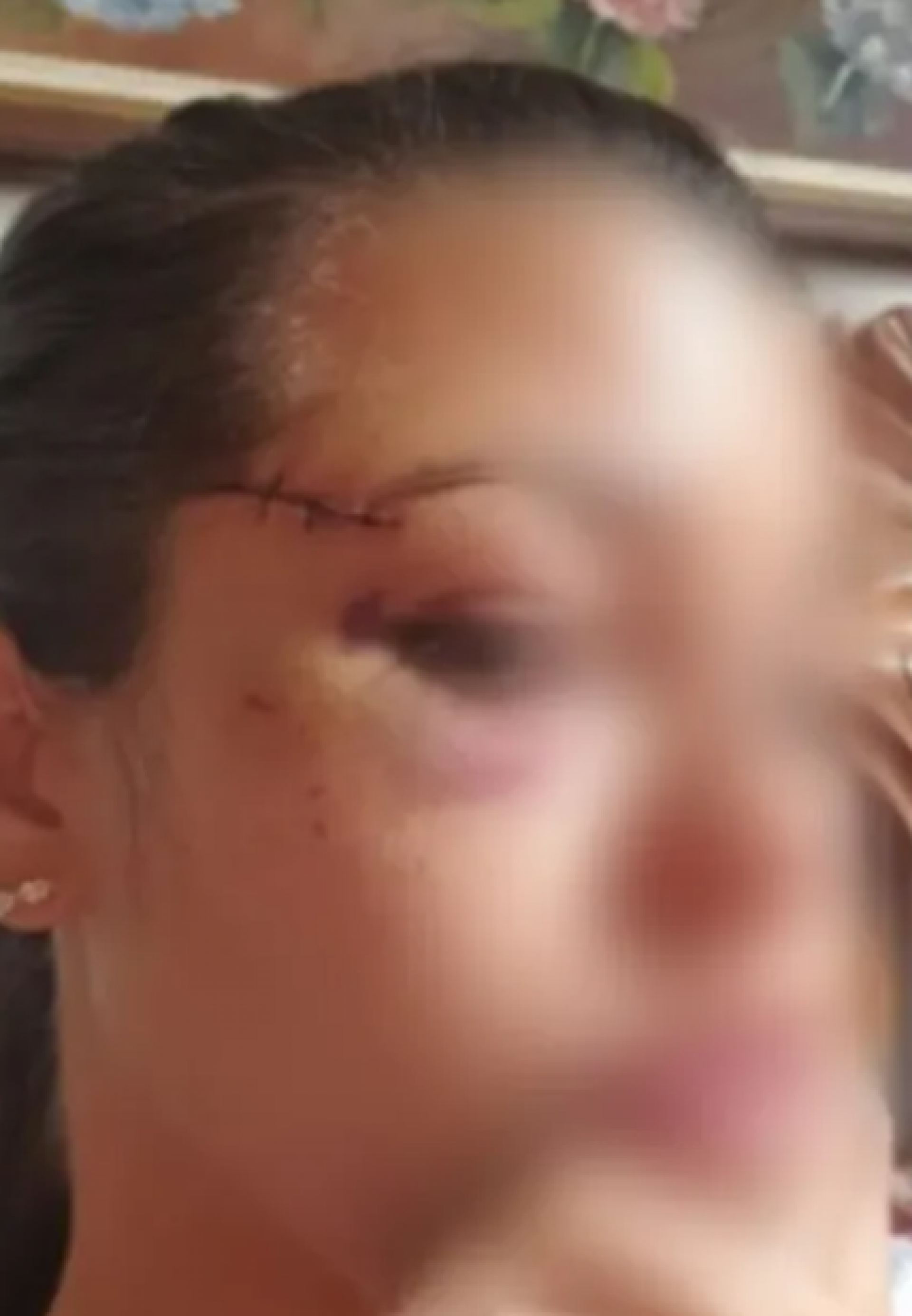 Ferimento no rosto da policial