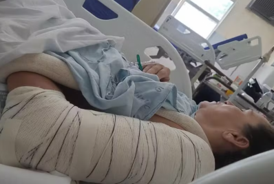 'Pensei que ia perder minha mãe', diz filha de mulher teve braço quebrado durante cirurgia na coluna