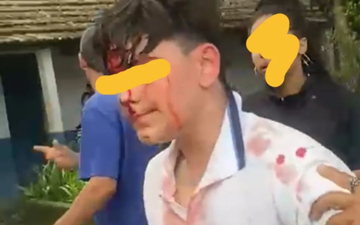 Adolescente de 13 anos precisou levar pontos na cabeça