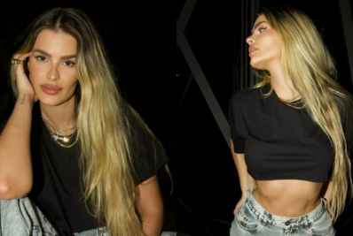 Yasmin Brunet detalha diagnósticos de lipedema e compulsão alimentar