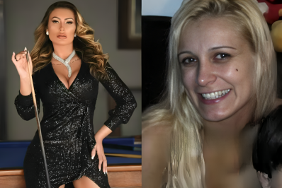 Andressa Urach choca web com antes e depois de procedimentos estéticos