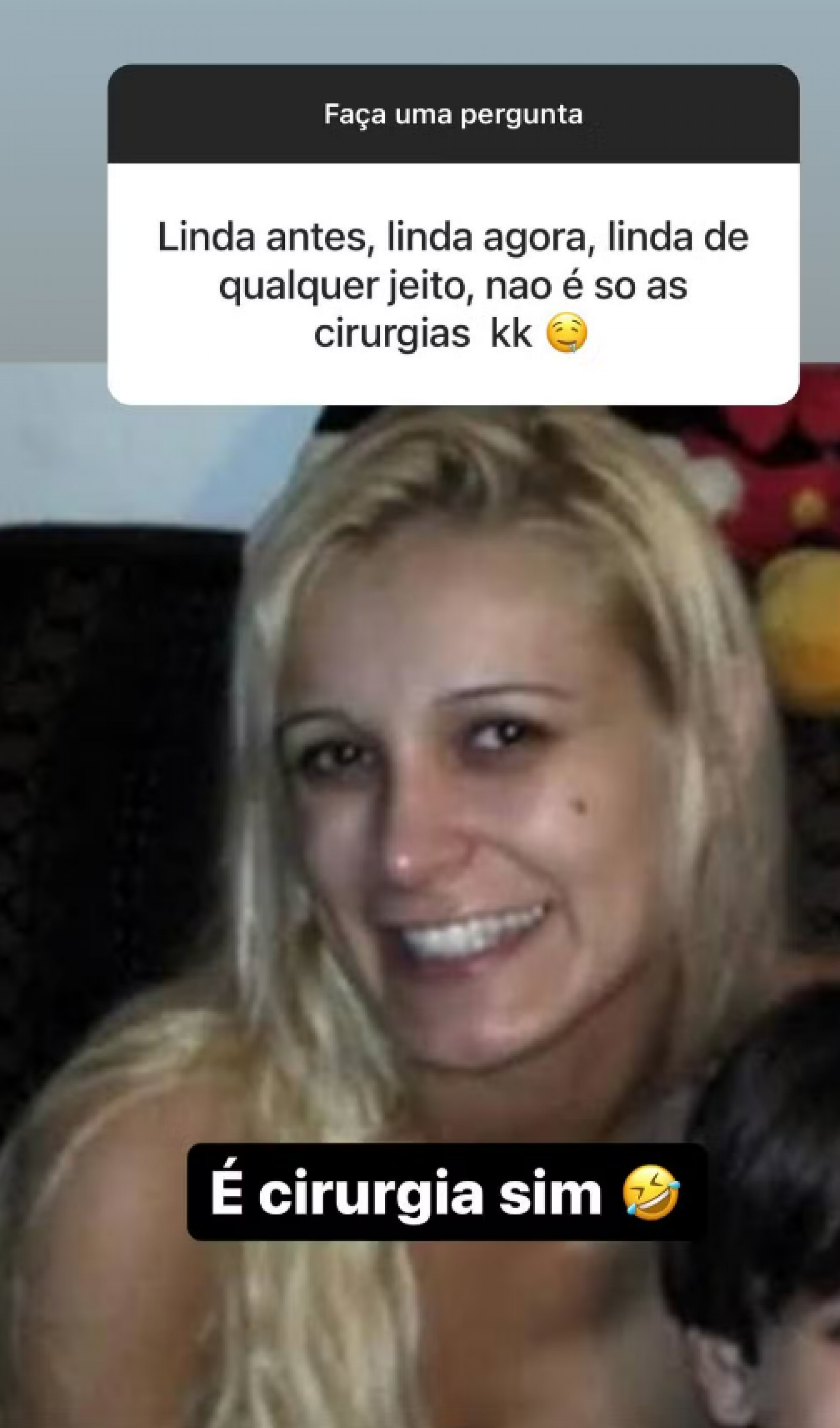 Andressa Urach choca web com antes e depois de procedimentos estéticos - Foto: Reprodução