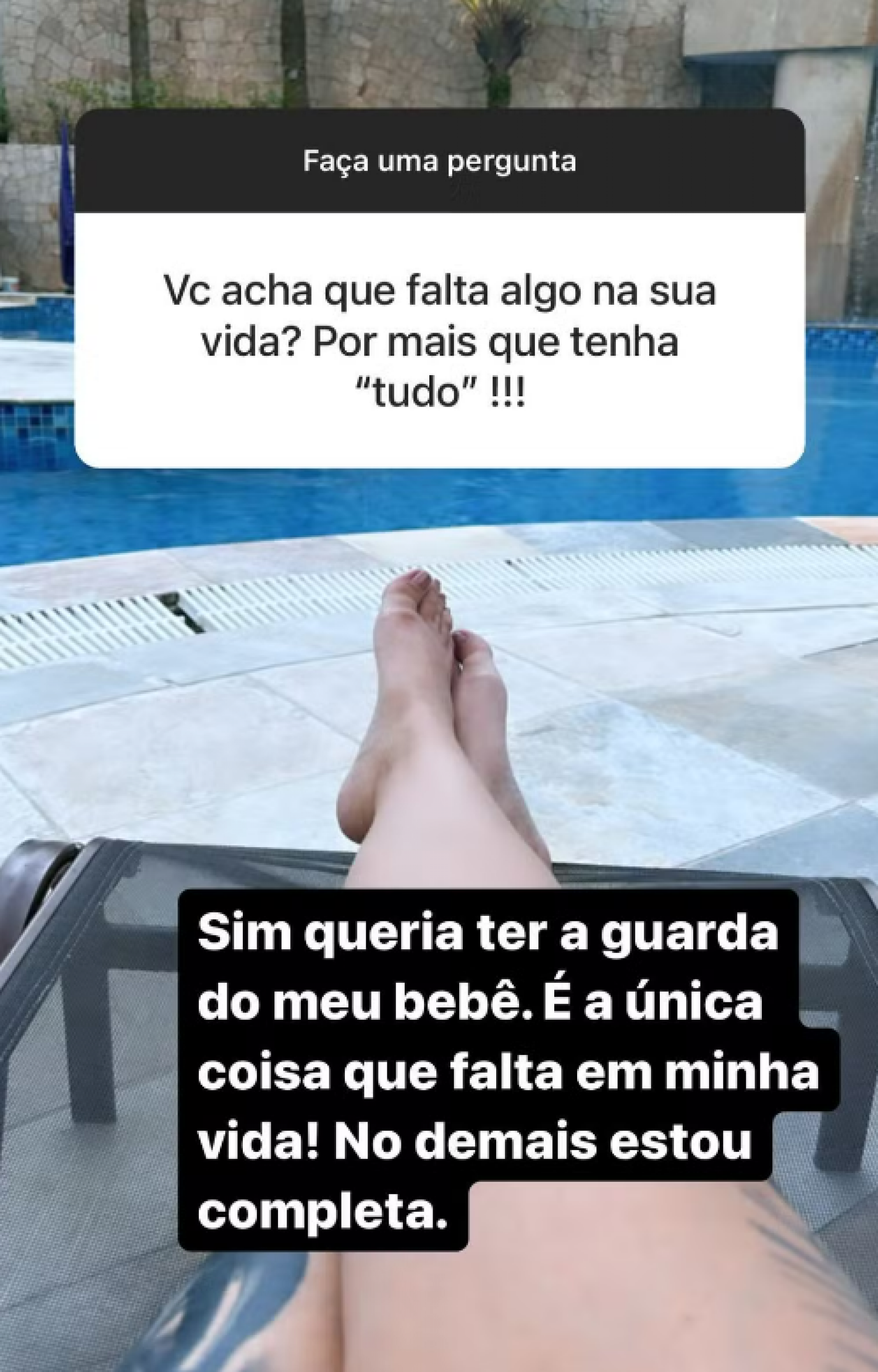 Andressa Urach choca web com antes e depois de procedimentos estéticos - Foto: Reprodução