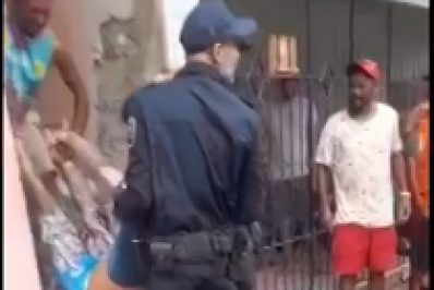 Jovem precisa amputar braço e perna após sofrer choque ao ajustar antena de televisão