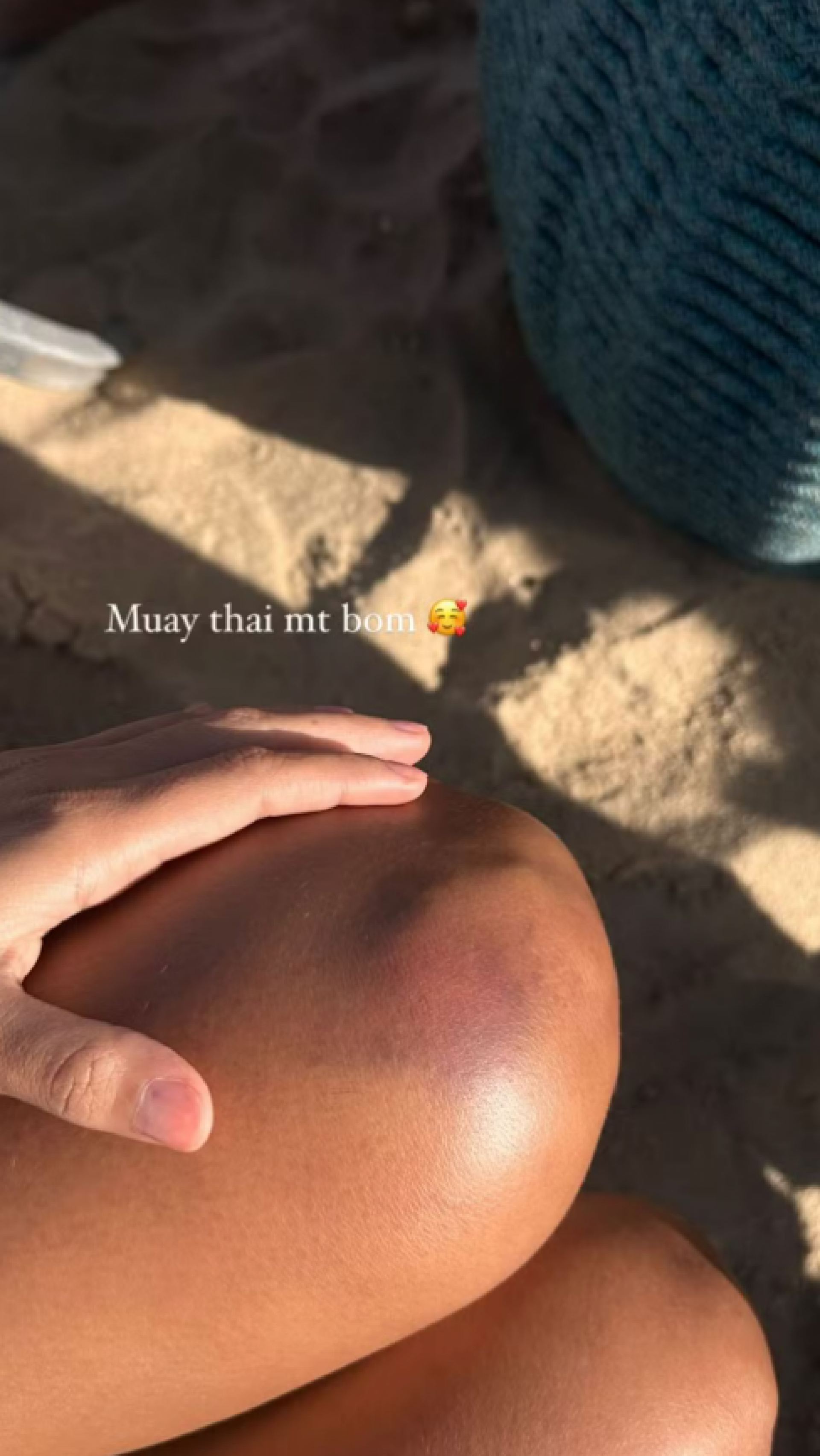 Bella Campos exibe hematoma após treino de Muay Thai e preocupa fãs - Foto: Reprodução