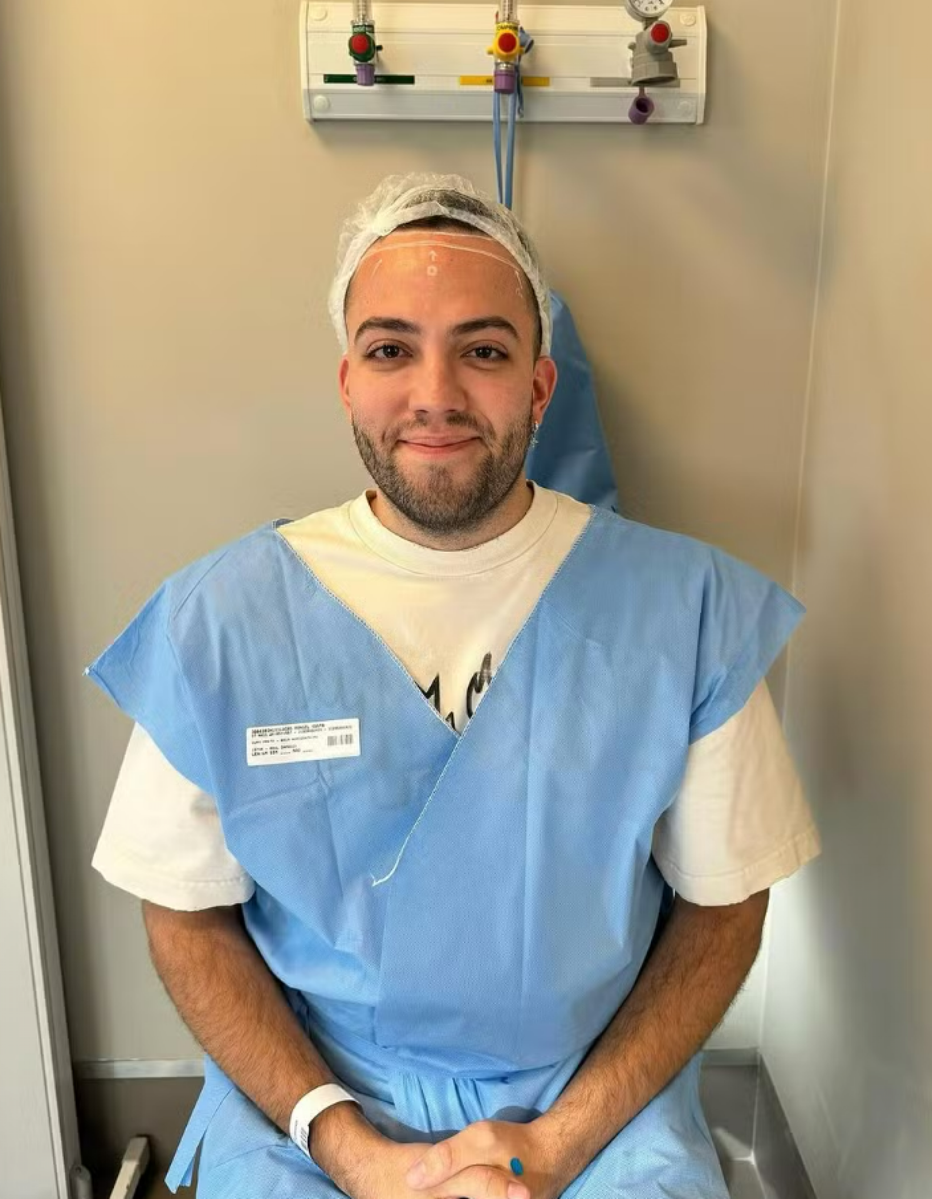 Lucas Rangel admite insegurança e faz cirurgia para diminuir testa - Foto: Reprodução