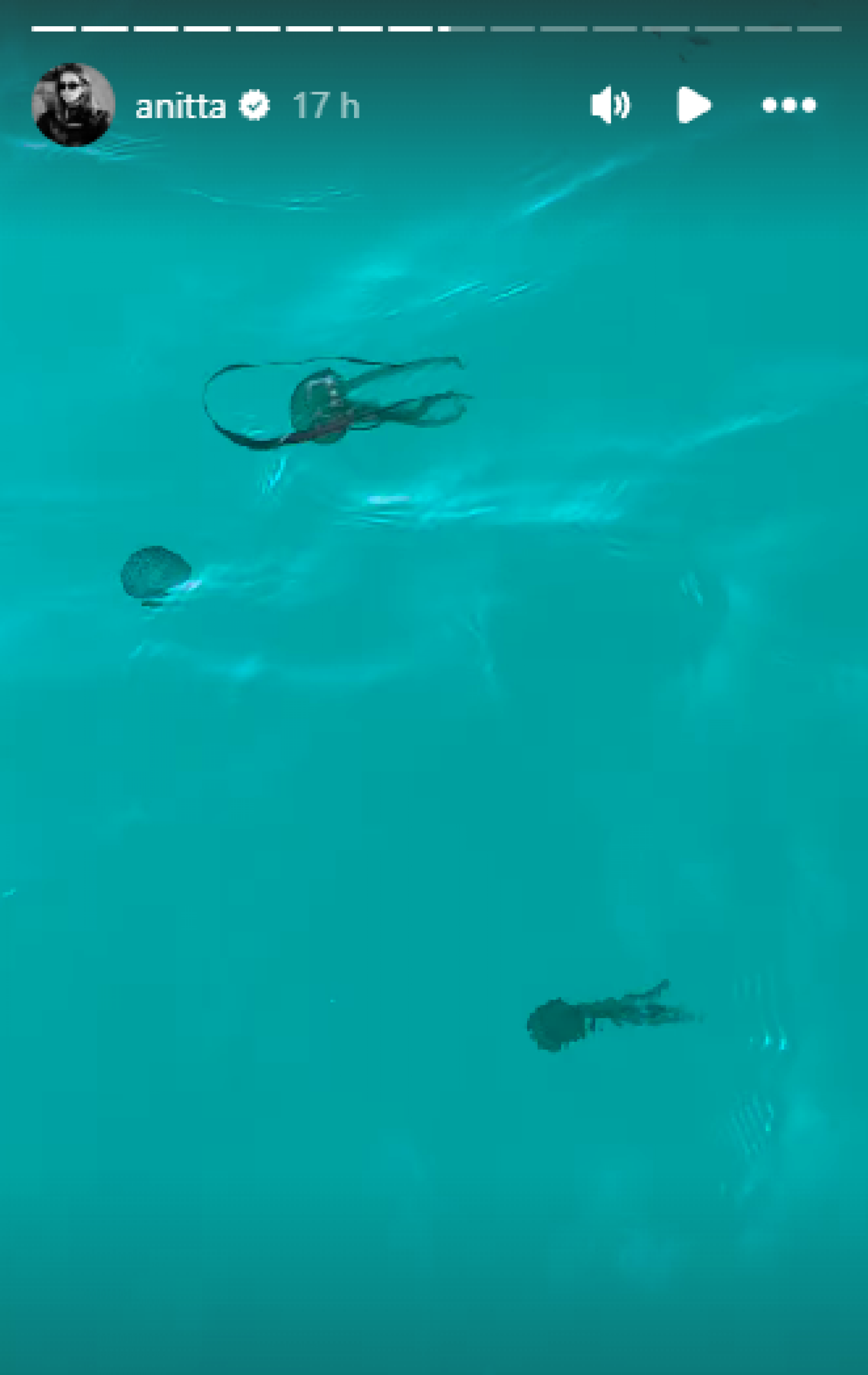 Anitta mostra como é a água-viva que a queimou em Ibiza - Reprodução de vídeo / Instagram