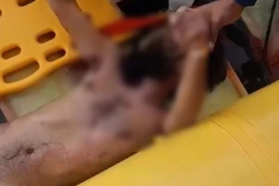 Homem fica gravemente ferido após pular de barco em Arraial do Cabo