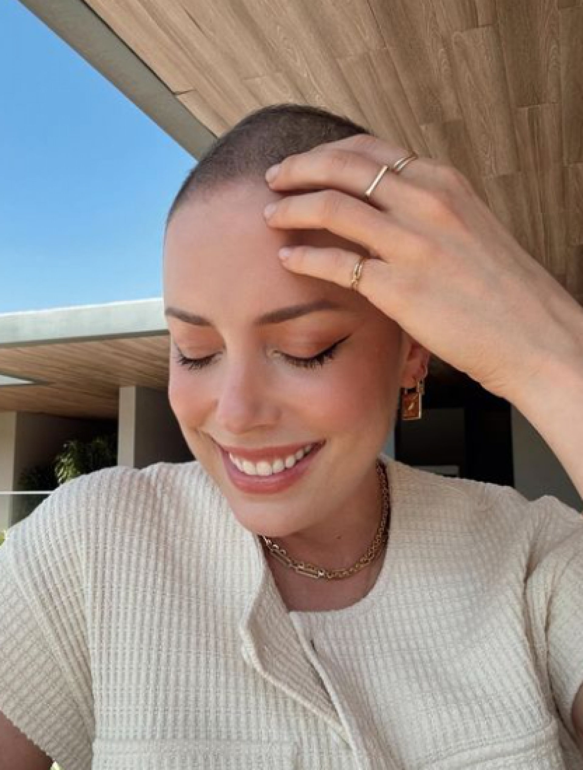 Fabiana Justus comemora crescimento do cabelo em tratamento de câncer: 'Me enxergar' - Reprodução / Instagram