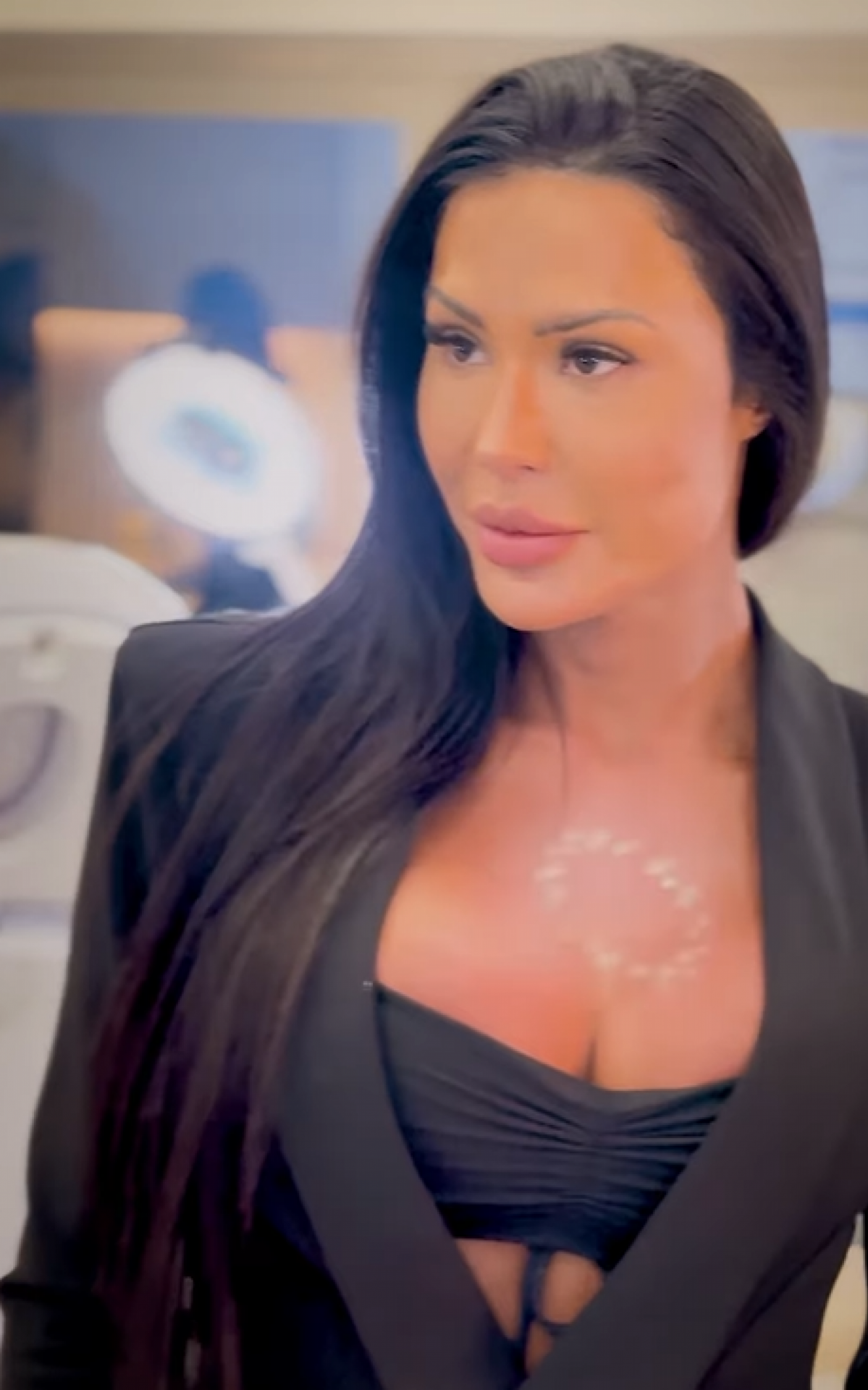 Gracyanne Barbosa faz procedimento para retirar procedimentos do rosto - Reprodução/Instagram