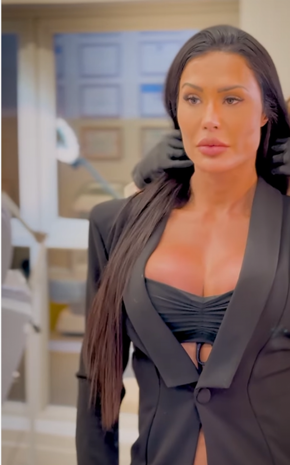 Gracyanne Barbosa faz procedimento para retirar procedimentos do rosto - Reprodução/Instagram