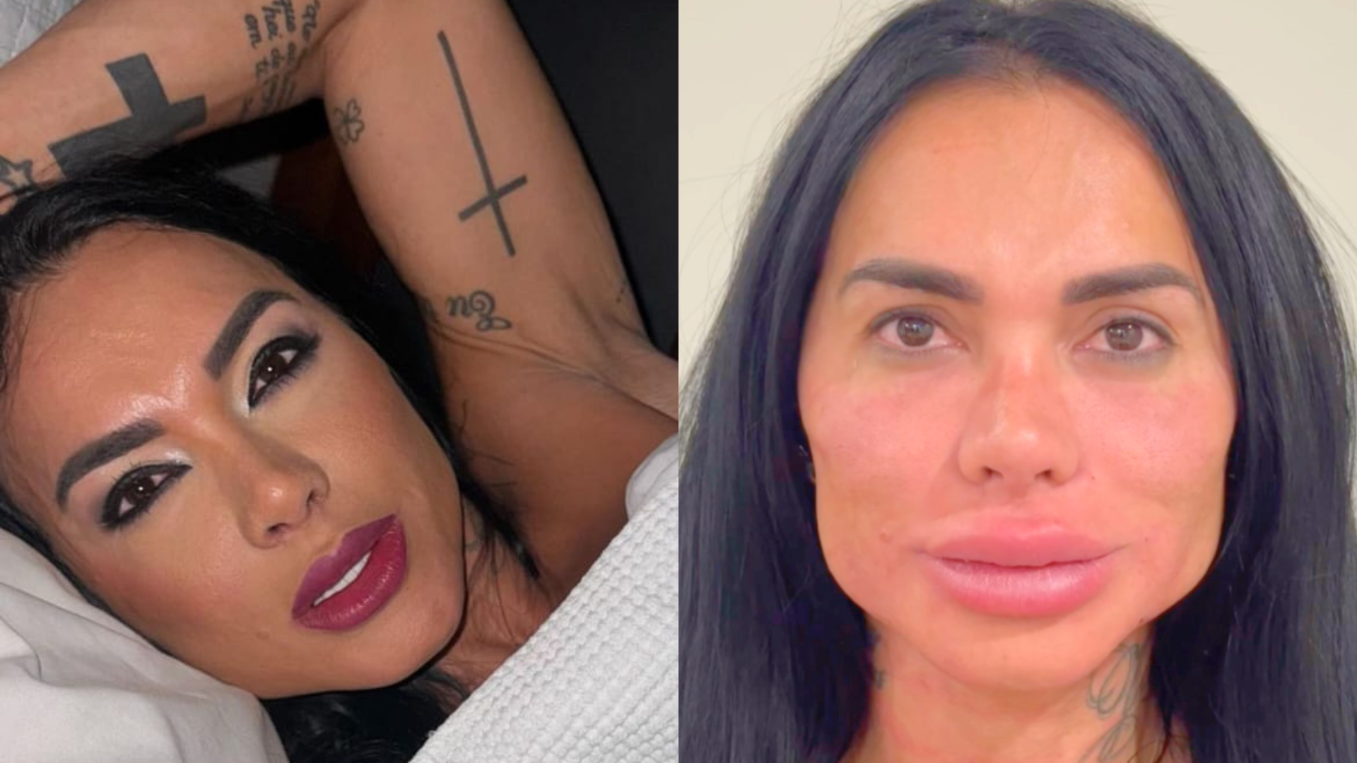 Kamila Simioni choca web ao exibir resultado de harmonização facial - Foto: Reprodução